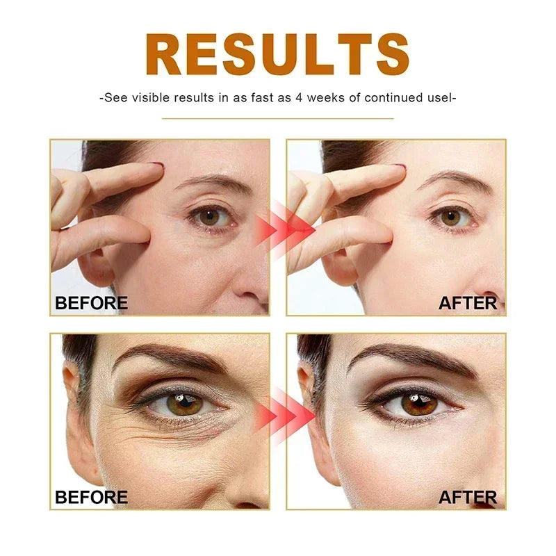 Collagen Wrinkle Removal Face Use Serum Anti-Aging Whitening Beauty Moisturizing Fade Fine Lines Dark Spots Brightening Cosmetic